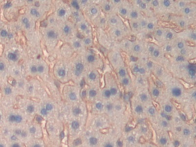 Polyclonal Antibody to Fibrinogen Beta Chain (FGB)