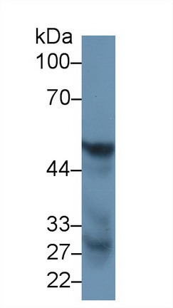 Polyclonal Antibody to Fibrinogen Beta Chain (FGB)