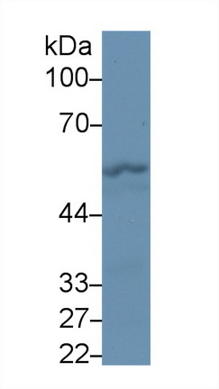 Polyclonal Antibody to Fibrinogen Beta Chain (FGB)