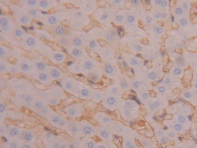 Polyclonal Antibody to Fibrinogen Beta Chain (FGB)