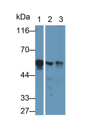 Polyclonal Antibody to Fibrinogen Beta Chain (FGB)