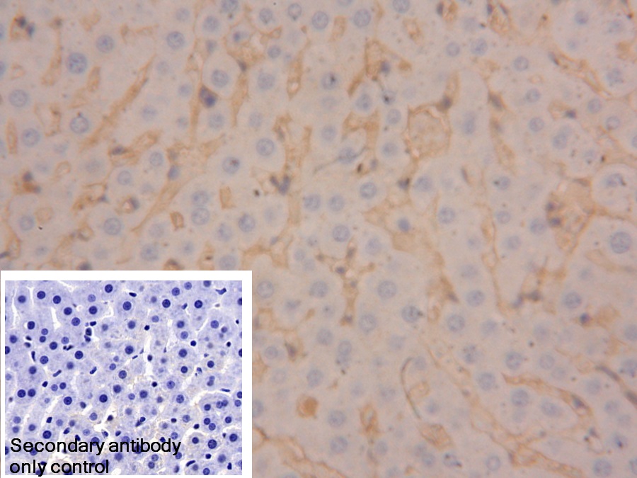 Polyclonal Antibody to Fibrinogen Beta Chain (FGB)