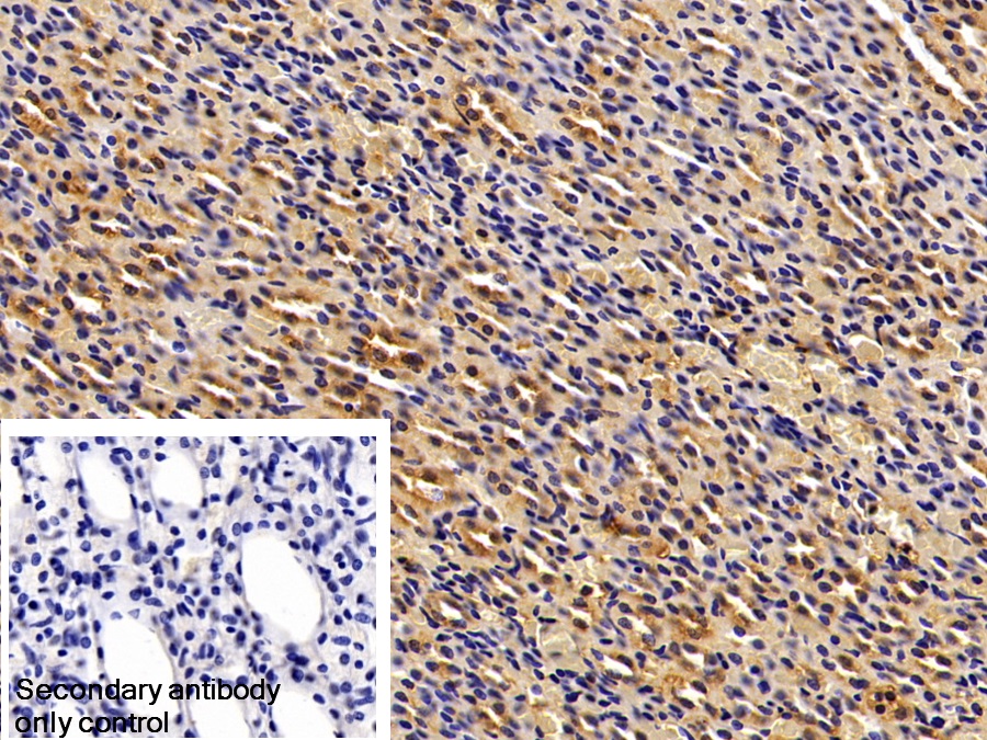 Polyclonal Antibody to Fibrinogen Beta Chain (FGB)