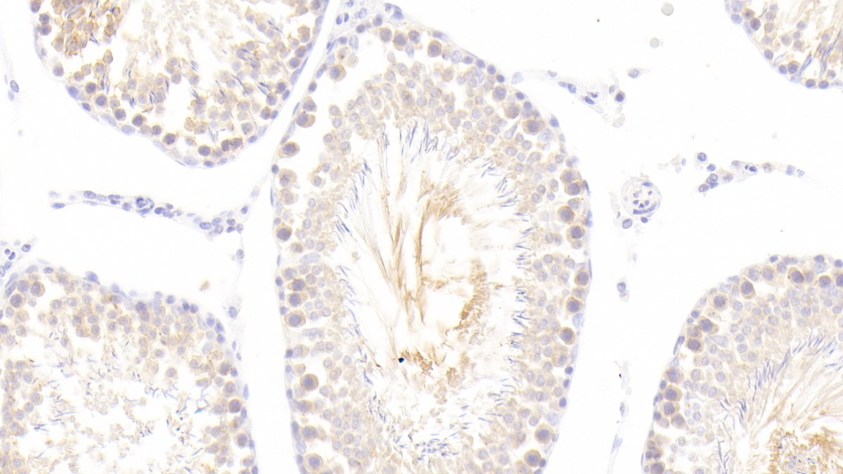 Polyclonal Antibody to Synuclein Alpha (SNCa)