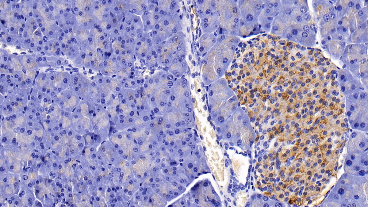 Polyclonal Antibody to Gastrin (GT)