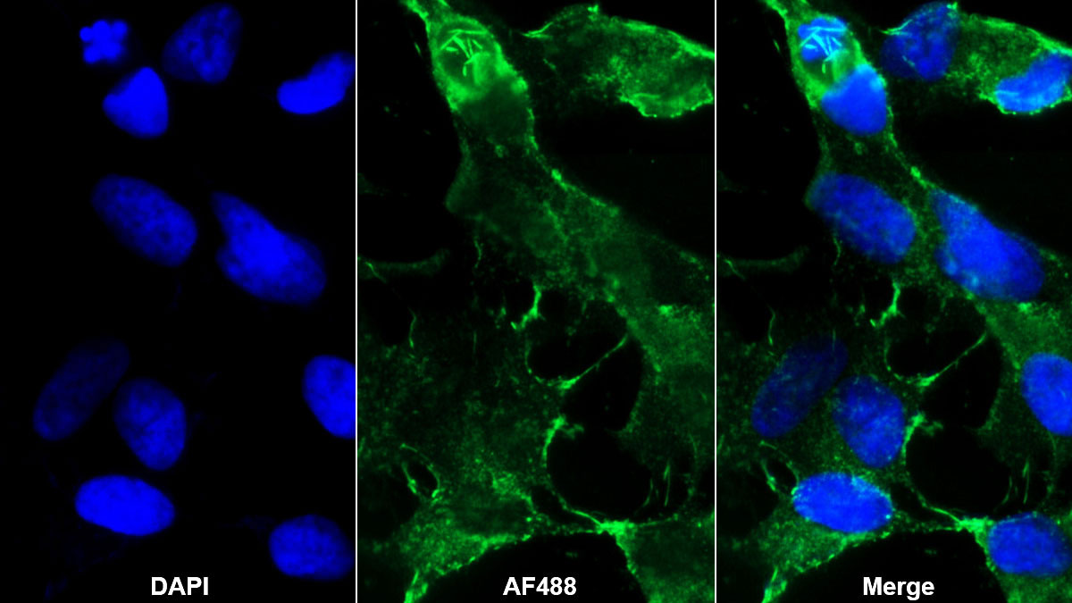 Polyclonal Antibody to Cluster Of Differentiation 56 (CD56)