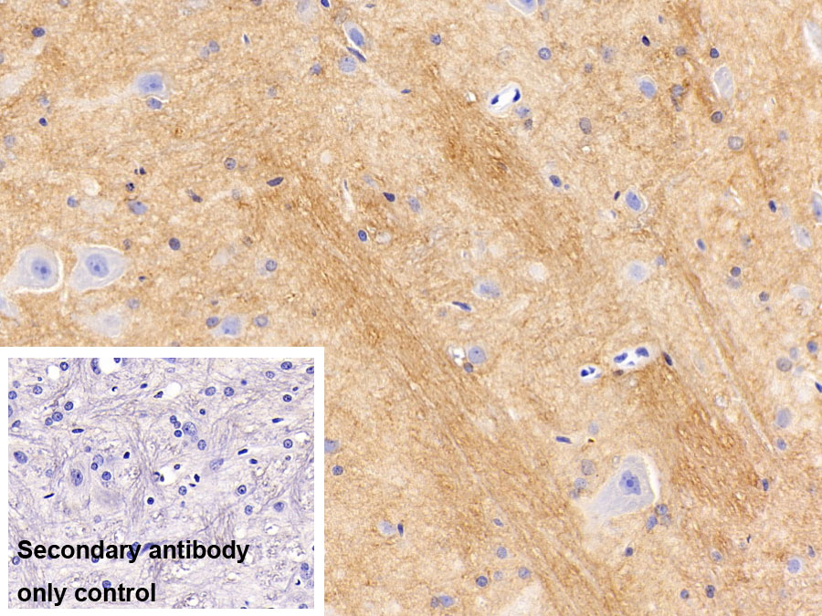 Polyclonal Antibody to Cluster Of Differentiation 56 (CD56)