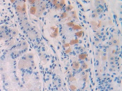 Polyclonal Antibody to Corticosteroid Binding Globulin (CBG)