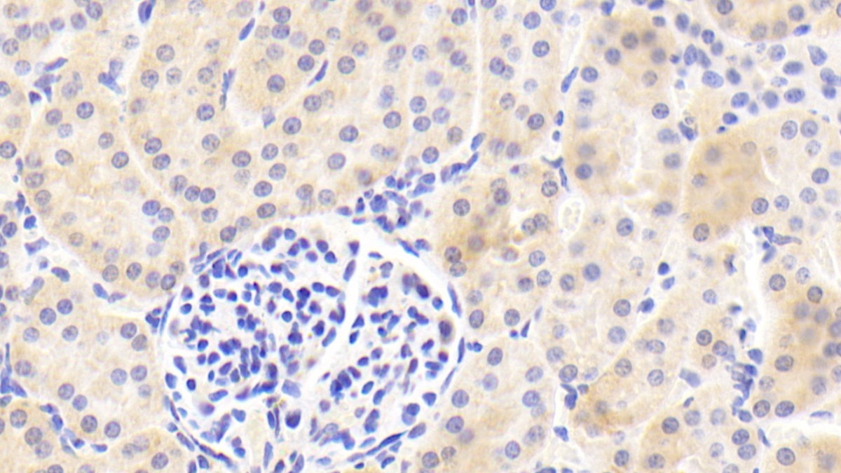 Polyclonal Antibody to Corticosteroid Binding Globulin (CBG)