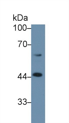 Polyclonal Antibody to Corticosteroid Binding Globulin (CBG)