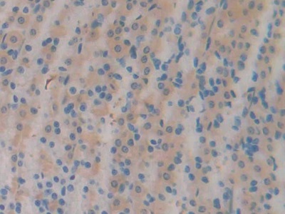 Polyclonal Antibody to Corticosteroid Binding Globulin (CBG)