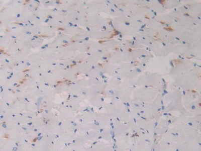 Polyclonal Antibody to Corticosteroid Binding Globulin (CBG)