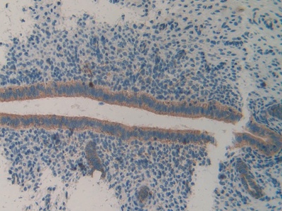 Polyclonal Antibody to Integrin Alpha 2 (ITGa2)