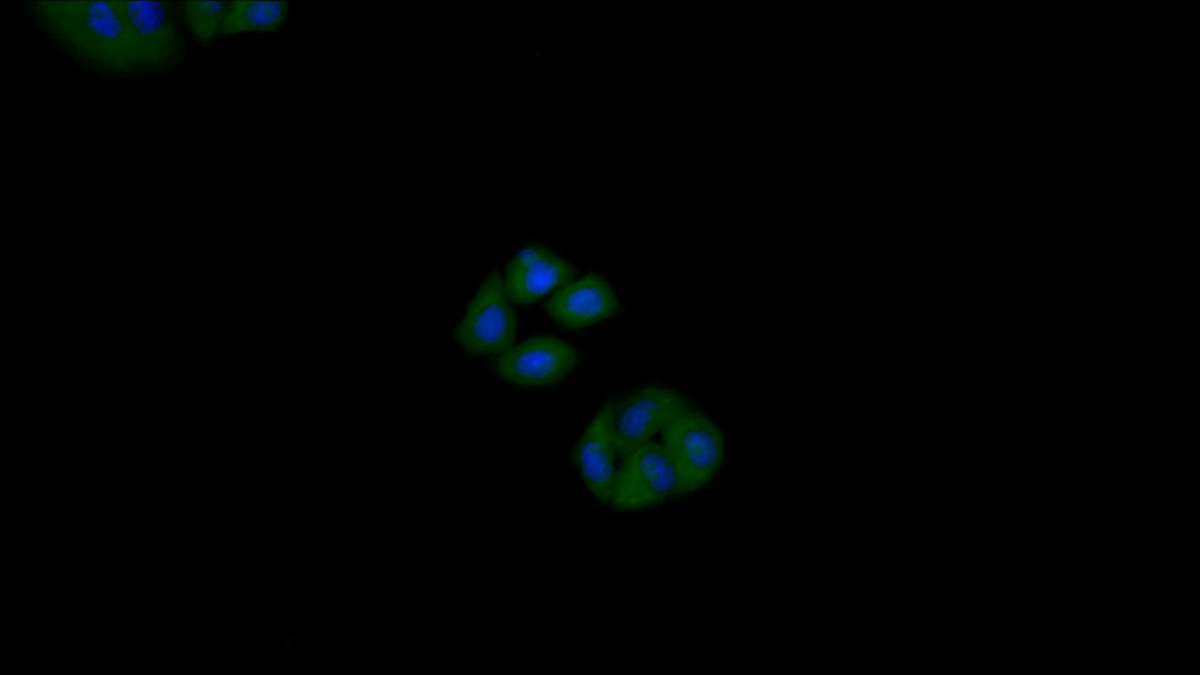 Polyclonal Antibody to Cytokeratin 18 (CK18)