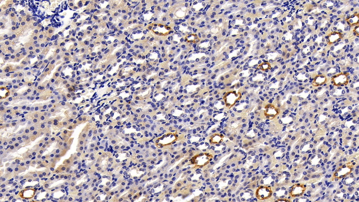 Polyclonal Antibody to Cytokeratin 18 (CK18)