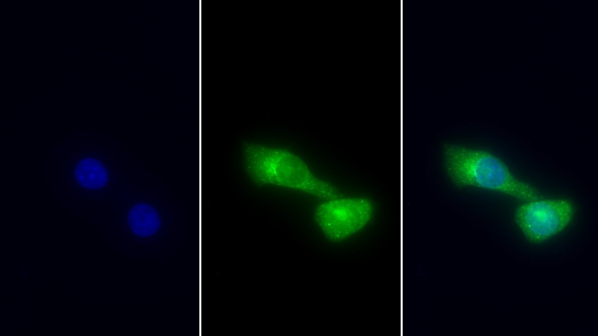 Polyclonal Antibody to Cytokeratin 18 (CK18)