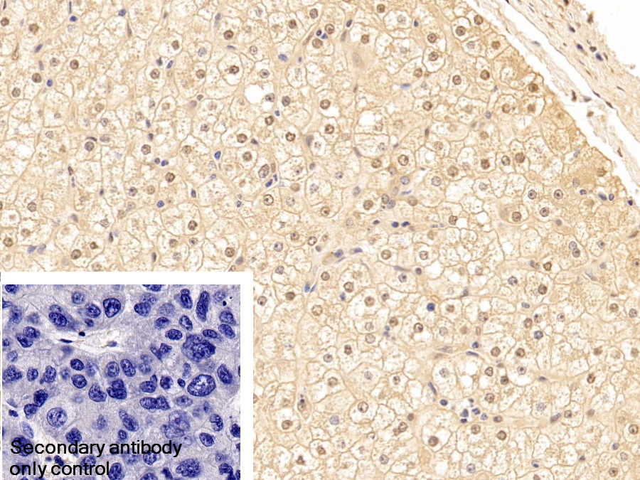 Polyclonal Antibody to Cytokeratin 18 (CK18)