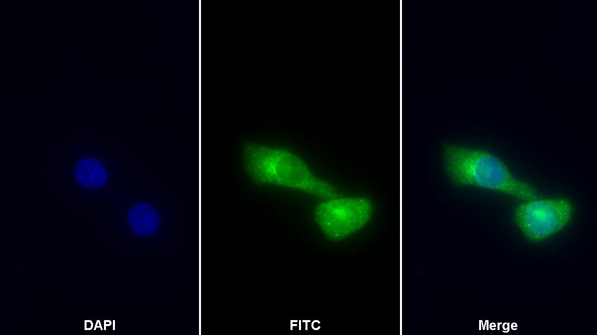 Polyclonal Antibody to Cytokeratin 18 (CK18)