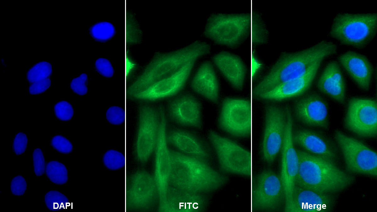 Polyclonal Antibody to Cytokeratin 18 (CK18)