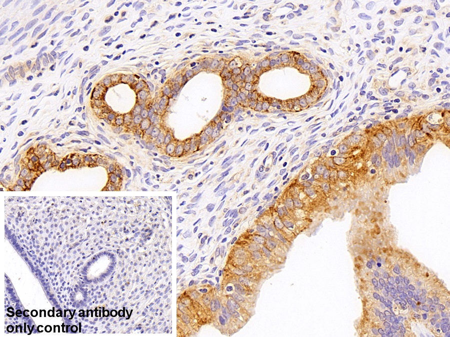 Polyclonal Antibody to Cytokeratin 18 (CK18)