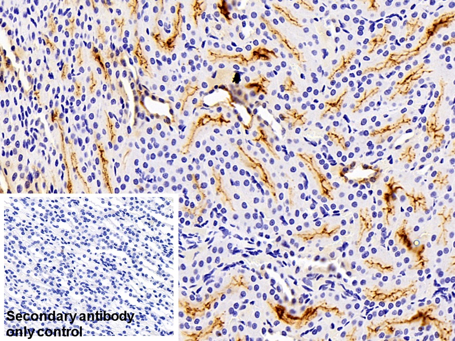 Polyclonal Antibody to Cytokeratin 18 (CK18)