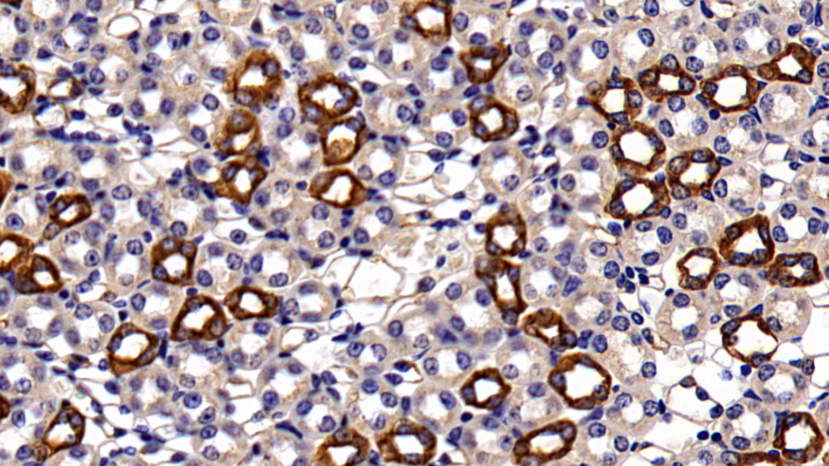 Polyclonal Antibody to Cytokeratin 18 (CK18)