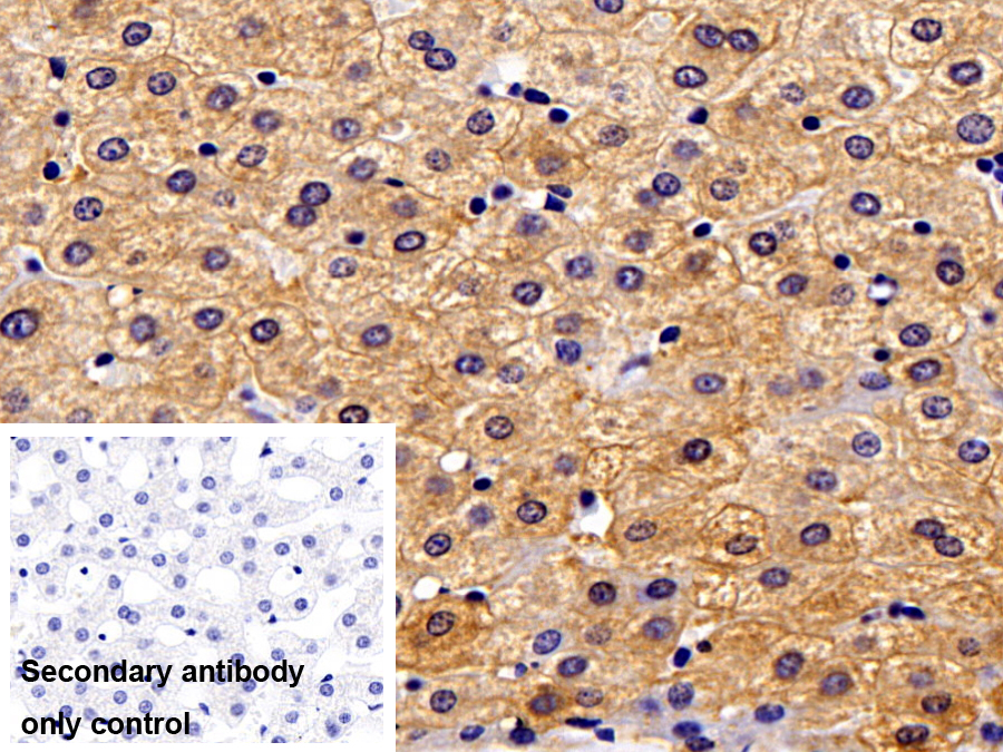 Polyclonal Antibody to Cytokeratin 18 (CK18)