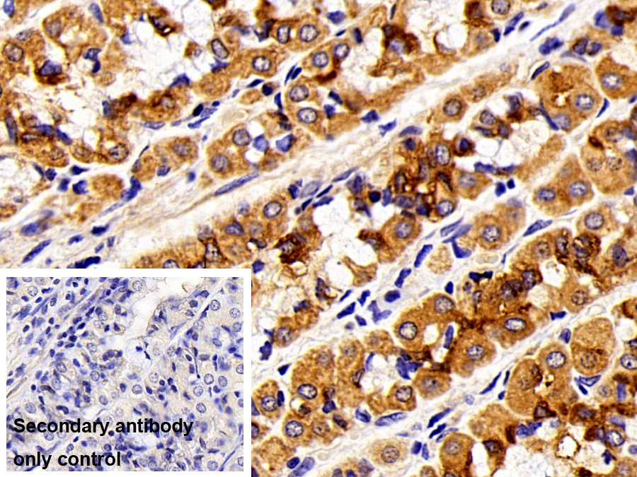 Polyclonal Antibody to Cytokeratin 18 (CK18)