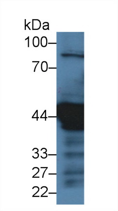 Polyclonal Antibody to Cytokeratin 18 (CK18)