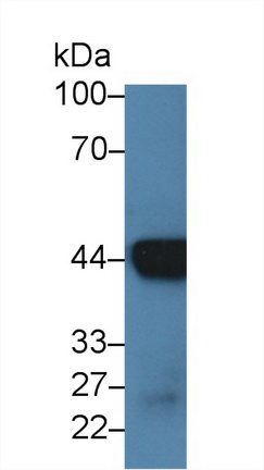 Polyclonal Antibody to Cytokeratin 18 (CK18)