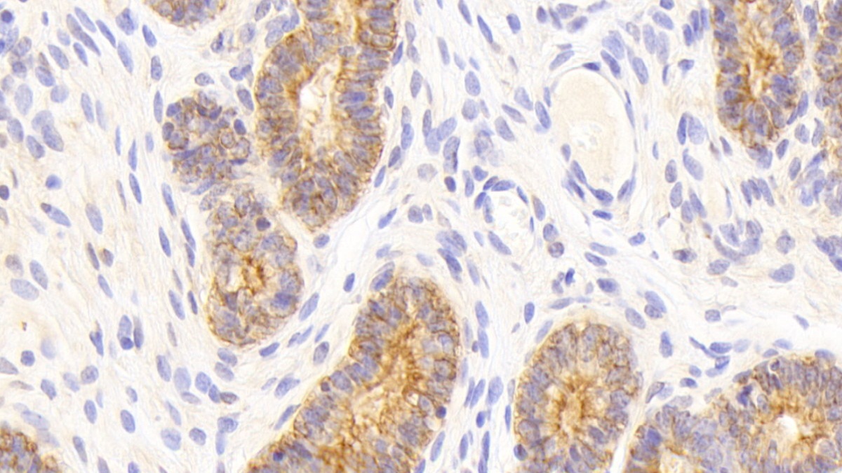 Polyclonal Antibody to Cytokeratin 18 (CK18)