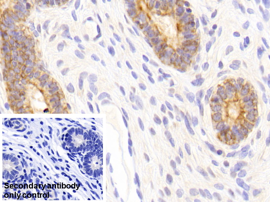 Polyclonal Antibody to Cytokeratin 18 (CK18)