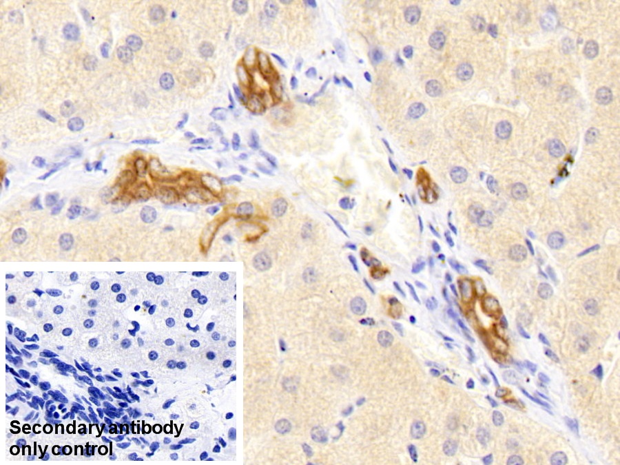 Polyclonal Antibody to Cytokeratin 18 (CK18)