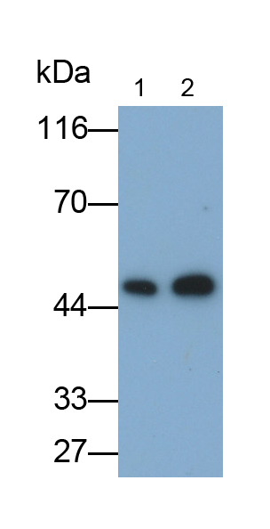 Polyclonal Antibody to Cytokeratin 18 (CK18)