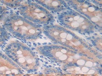 Polyclonal Antibody to Cytokeratin 18 (CK18)