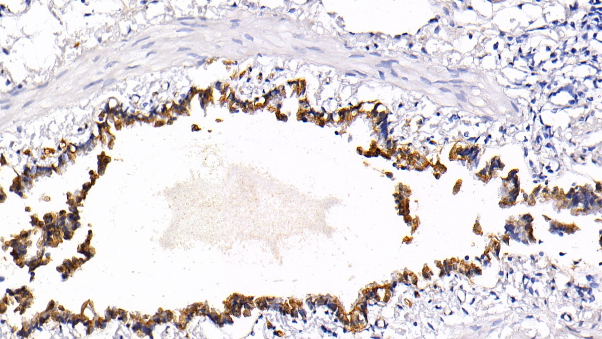 Polyclonal Antibody to Cytokeratin 18 (CK18)