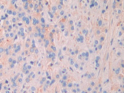 Polyclonal Antibody to Matrix Extracellular Phosphoglycoprotein (MEPE)