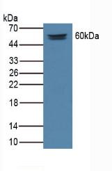 Polyclonal Antibody to Matrix Extracellular Phosphoglycoprotein (MEPE)