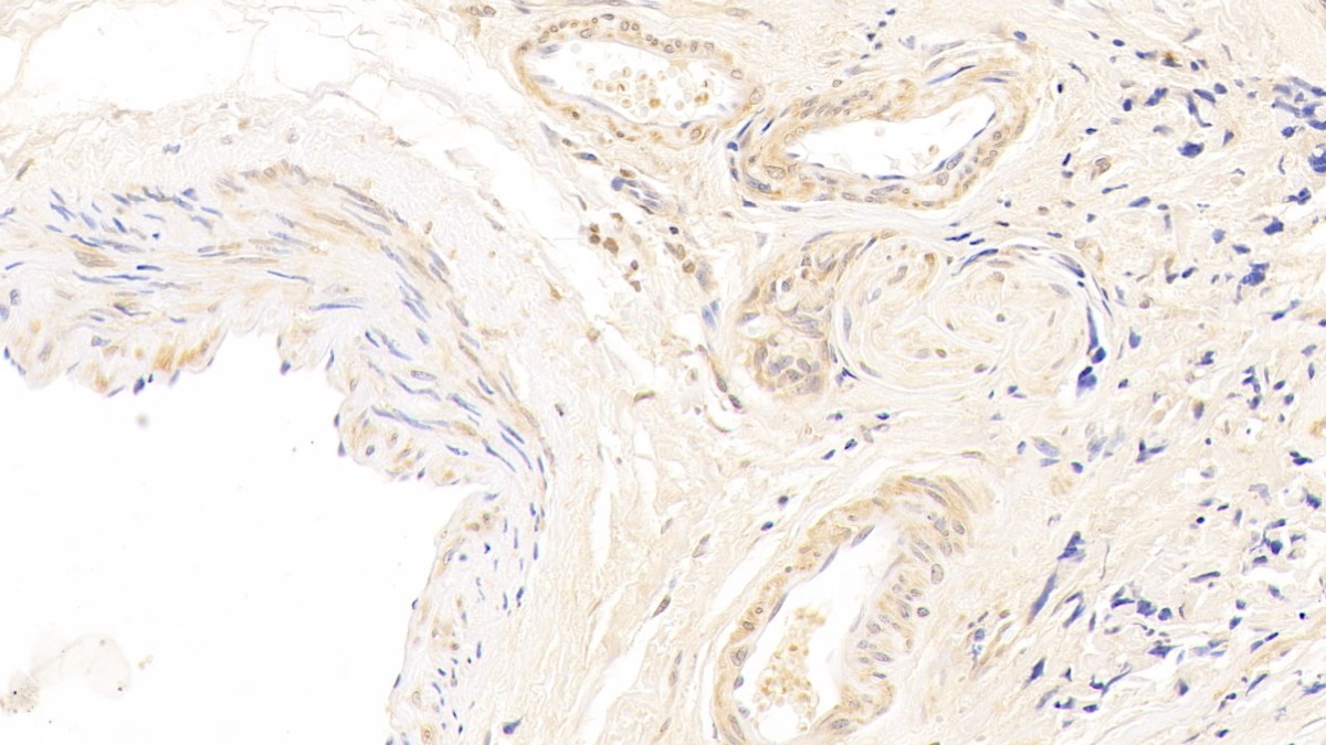 Polyclonal Antibody to Cyclin Dependent Kinase 4 (CDK4)