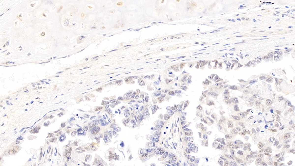 Polyclonal Antibody to Cyclin Dependent Kinase 4 (CDK4)