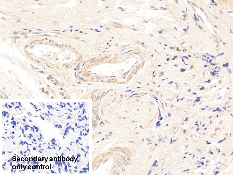 Polyclonal Antibody to Cyclin Dependent Kinase 4 (CDK4)