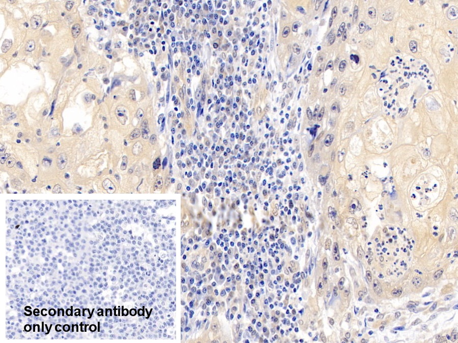 Polyclonal Antibody to Cyclin Dependent Kinase 4 (CDK4)