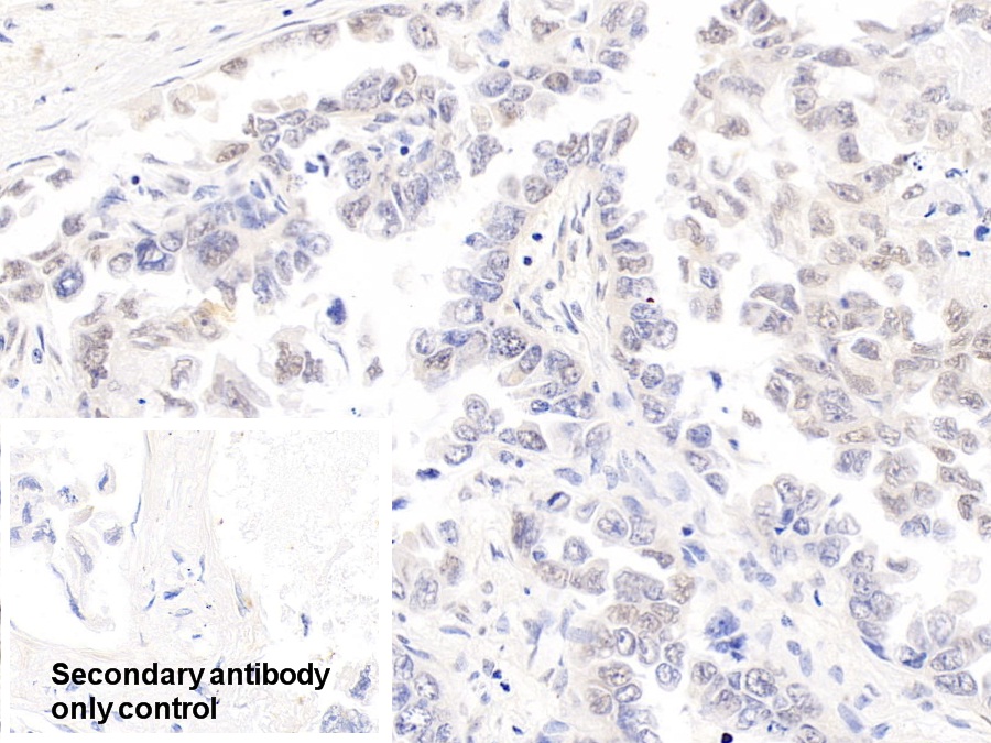 Polyclonal Antibody to Cyclin Dependent Kinase 4 (CDK4)