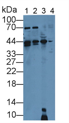 Polyclonal Antibody to Cyclin Dependent Kinase 4 (CDK4)