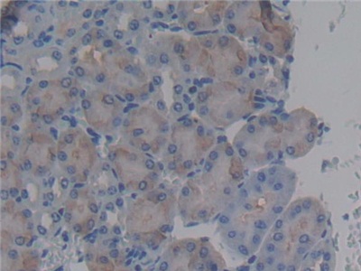 Polyclonal Antibody to Bactericidal/Permeability Increasing Protein (BPI)