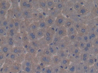 Polyclonal Antibody to Bactericidal/Permeability Increasing Protein (BPI)