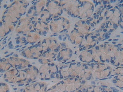 Polyclonal Antibody to Bactericidal/Permeability Increasing Protein (BPI)