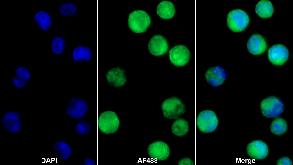 Polyclonal Antibody to Bactericidal/Permeability Increasing Protein (BPI)