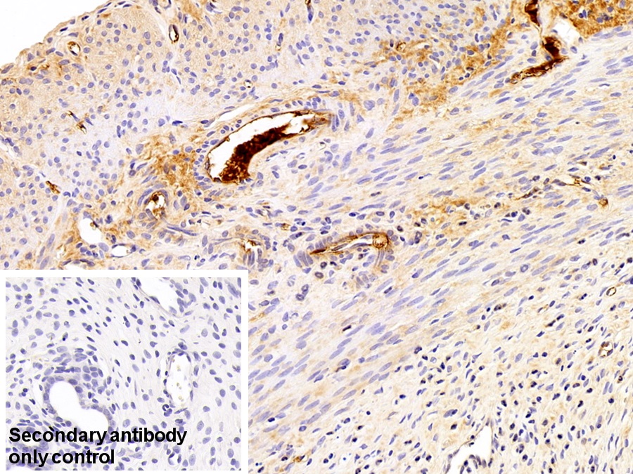 Polyclonal Antibody to Fibrinopeptide A (FPA)