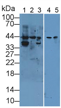 Polyclonal Antibody to Cytokeratin 19 (CK19)